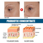 Probiotics Concentrated Anti-wrinkle Serum Hydrating And Firming